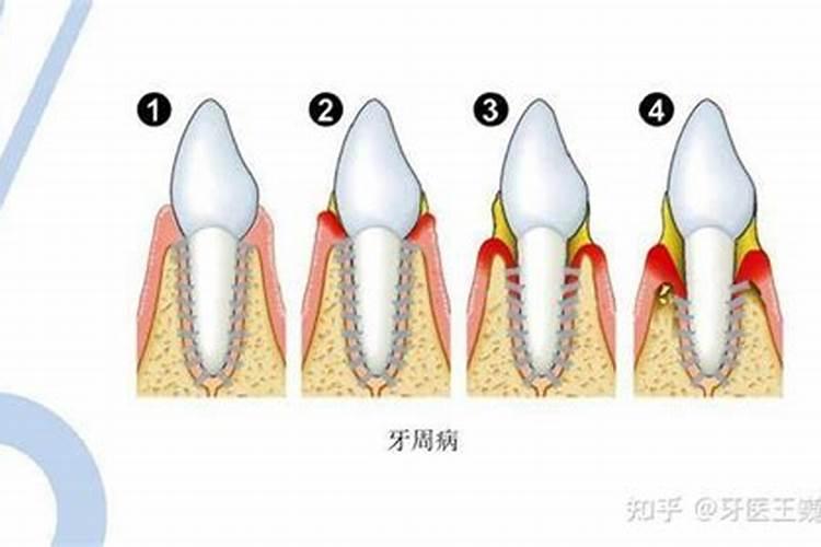 女人梦到牙齿松动然后用手拔掉了