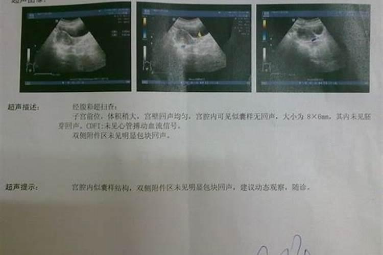 打胎后怎么给孩子超度