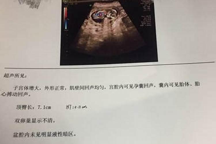 堕胎孩子如何超度？