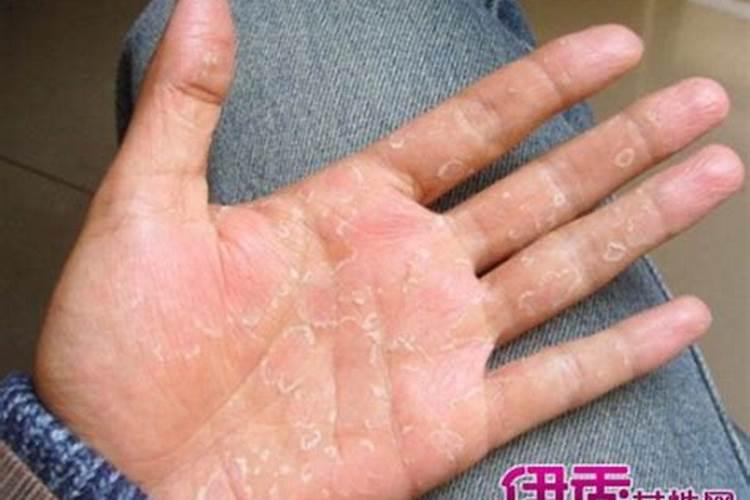 如何从手相判断人一生的寿命 生命线图解？