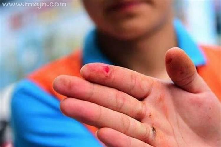 梦见自己手流血是什么预兆