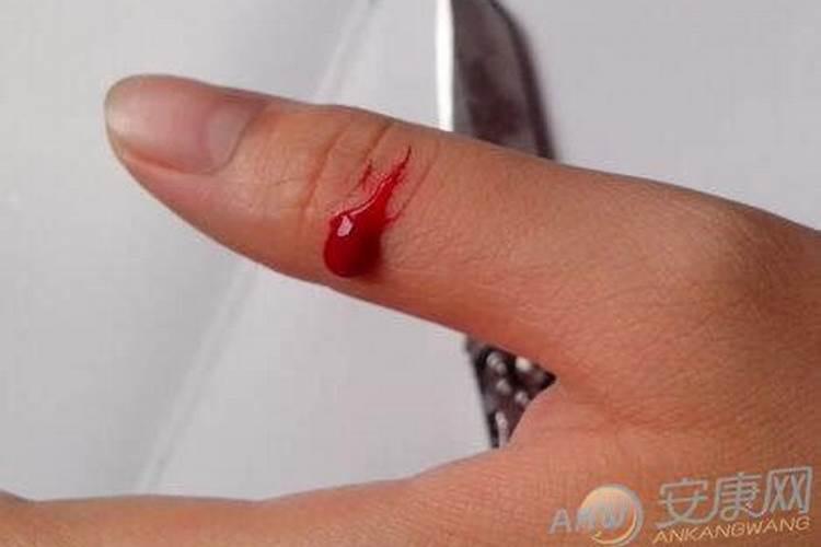 梦见亲人刀伤流血的预兆