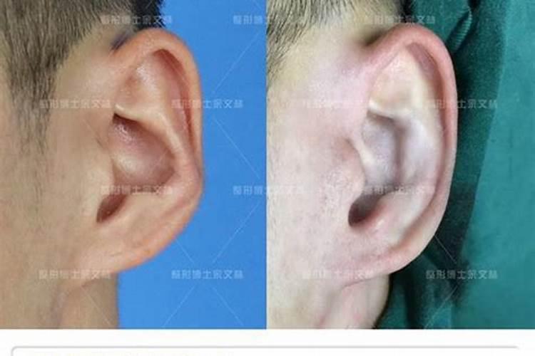 耳朵有反骨的女人命运好不好？