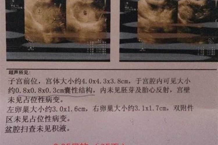 1984年正月25生属鼠,请问是什么星座
