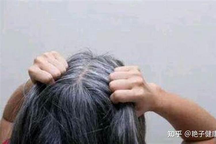 梦见别人满头白发的预兆
