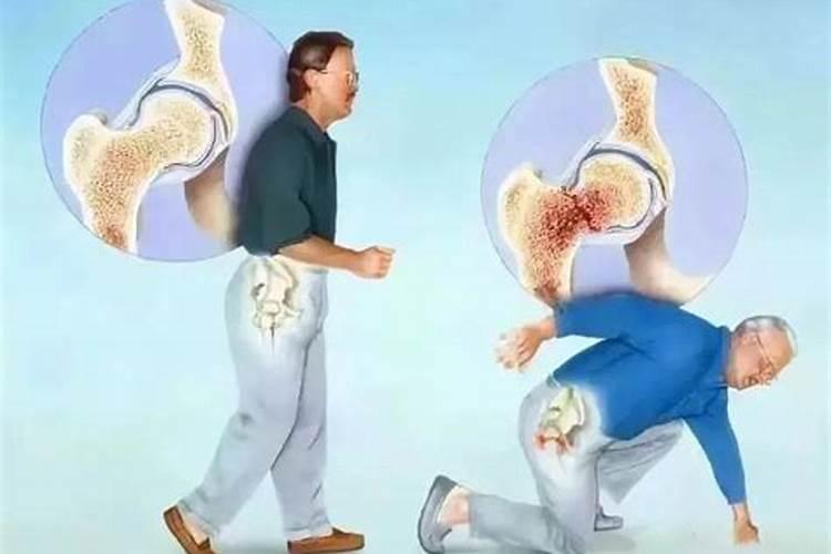 骨折是为家人挡煞吗