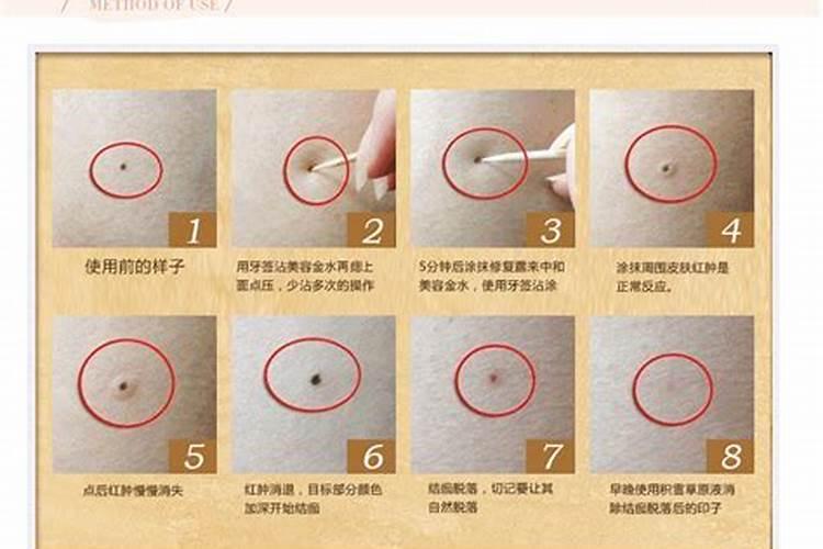 右眉毛上的肉痣要不要点？会影响运势吗？