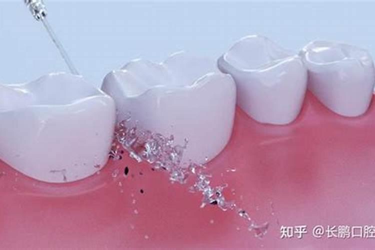 犯太岁的化解