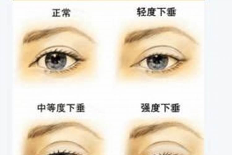 眼皮跳时辰测吉凶预兆关于眼皮跳时辰测吉凶预兆