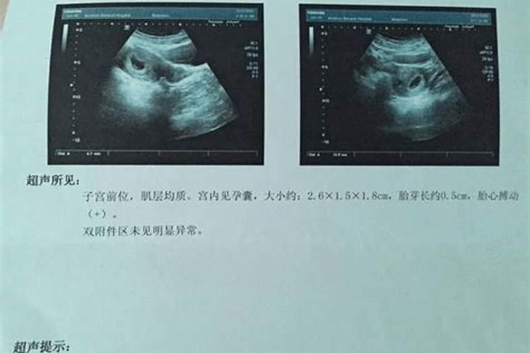 运气不好的人怎样改变自己的运气