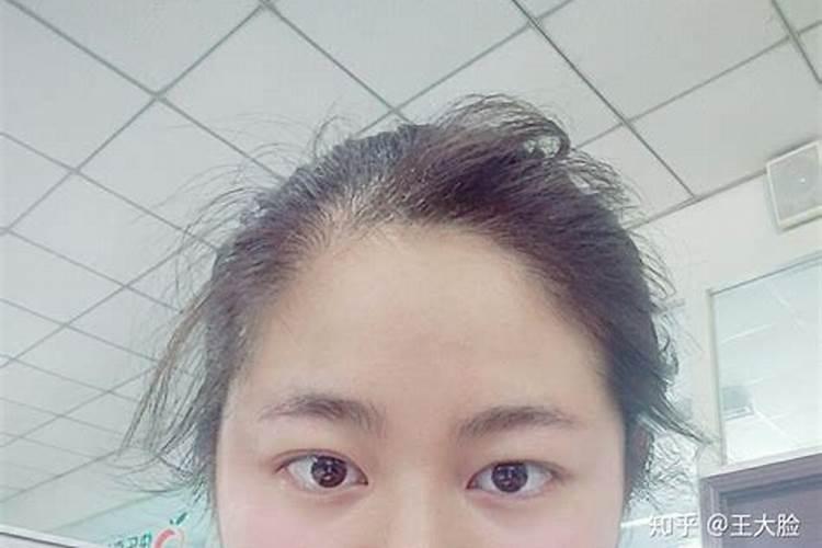 发际线低的人命好不好
