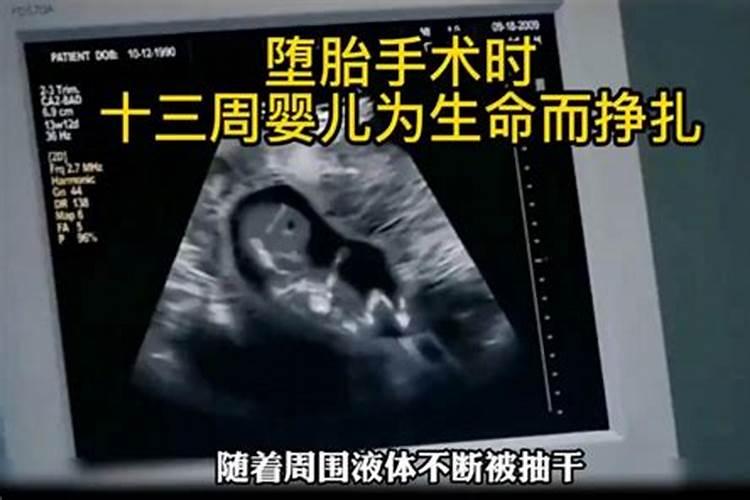 拉斐尔 西斯廷圣母 这幅画背后有很多模糊的小孩的脸,是什么意思？他百 ...