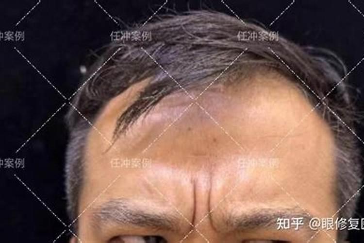 运势要把握,中年运势下滑的面相特征