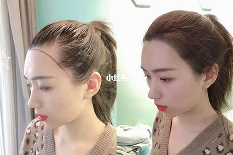女人额头发际线高好不好福气饱满好运来临？