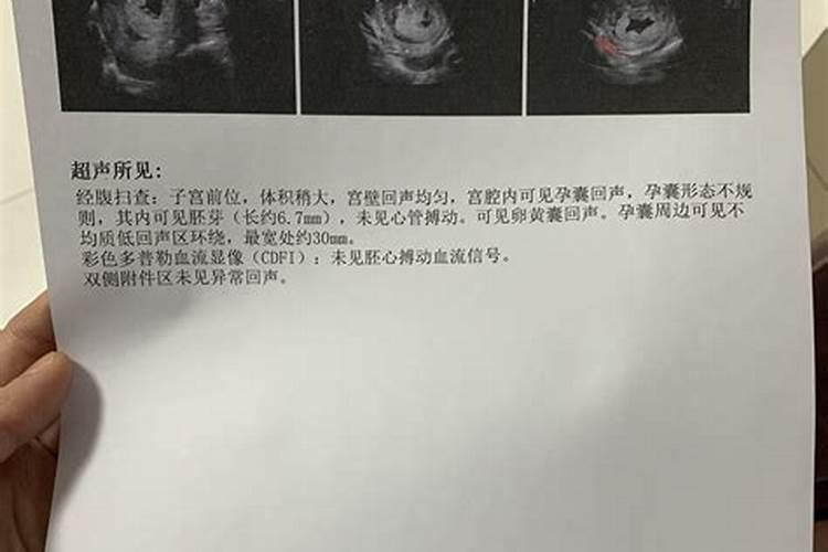 2024年腊月是几号到几号