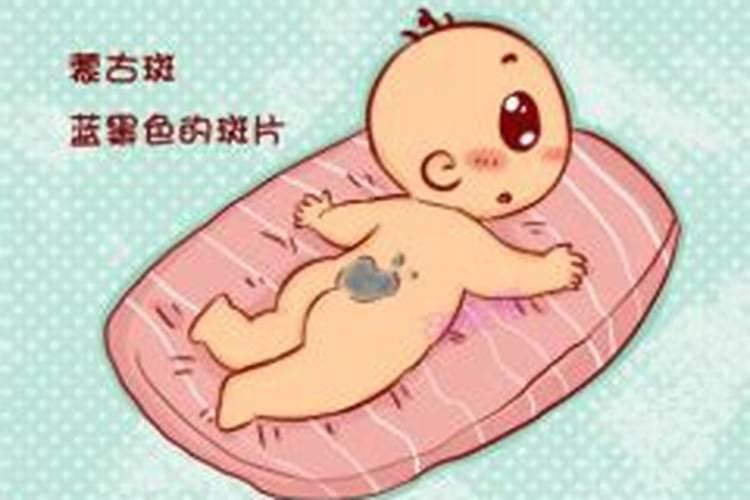 肚脐周围有痣