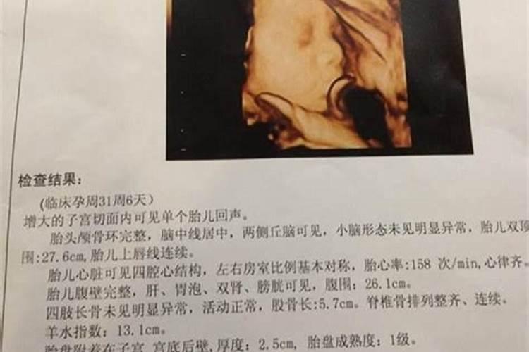 化解犯太岁最佳方法