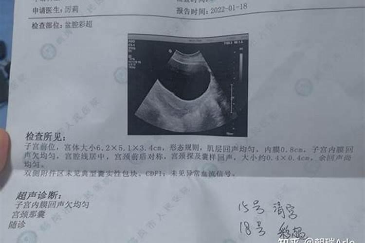 属蛇哪年运势最旺