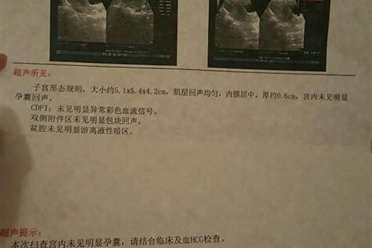 属猴几月出生最好