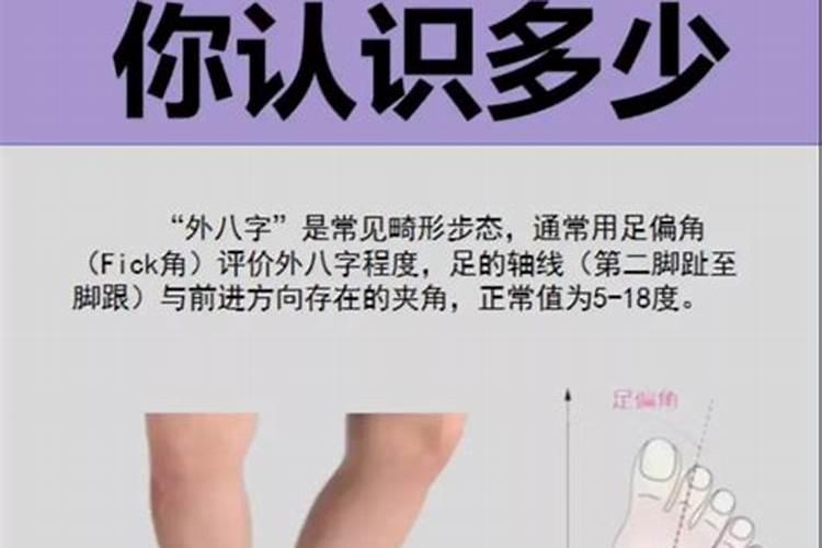 外八字可以当兵不