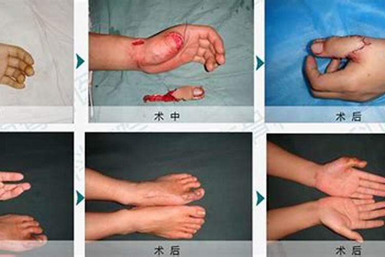 梦见肢体接触的预兆