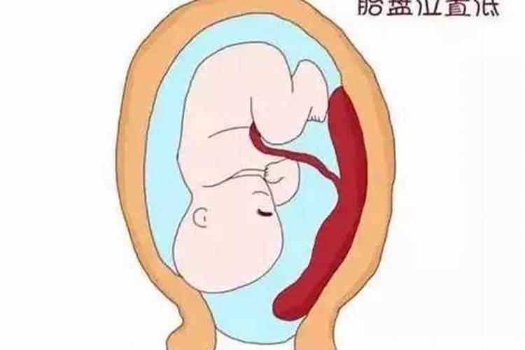 胎盘怎么处理最好风水