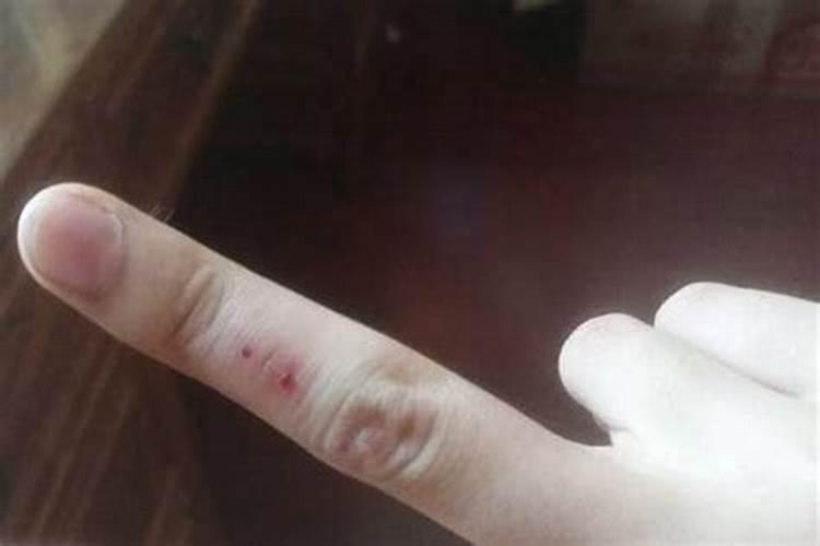 梦见自己的手烂个窟窿有什么征兆