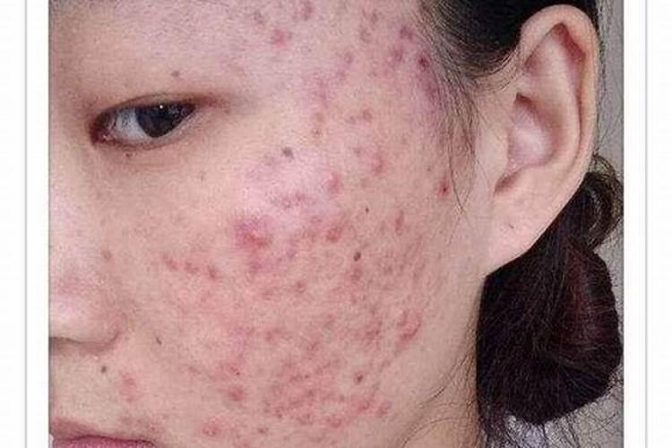 鼠和猴的婚姻如何