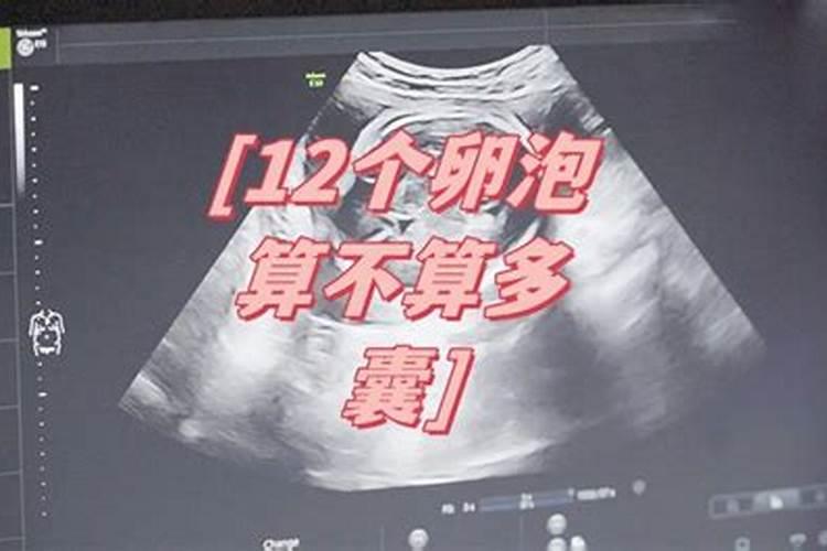 大师请推算本人一生的运势 越详细越好