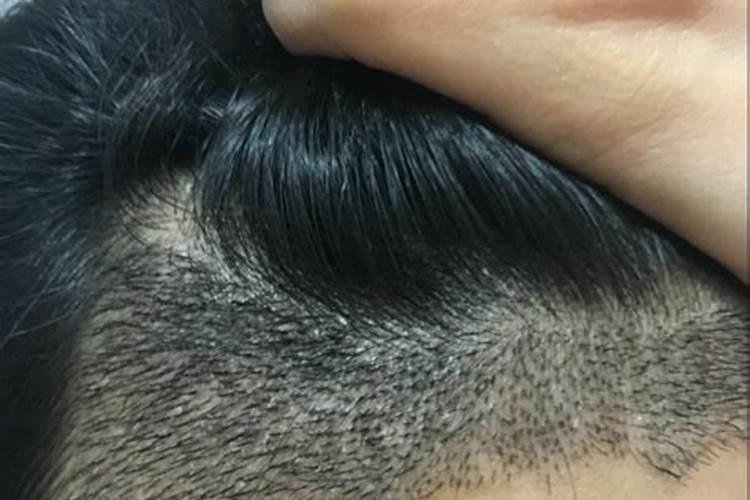 为什么说发际线对面相的影响很大？