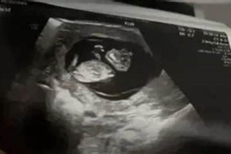 流产的婴儿有灵魂吗佛法莲蓬鬼话  百度宝宝知道