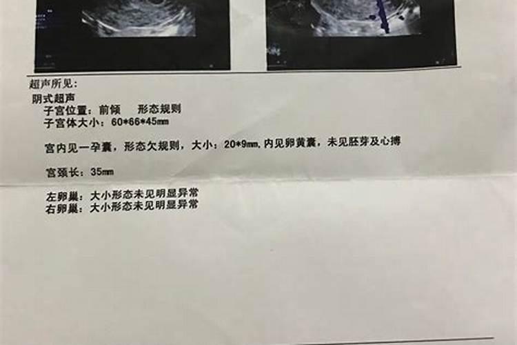 如何化解堕胎婴灵的怨气