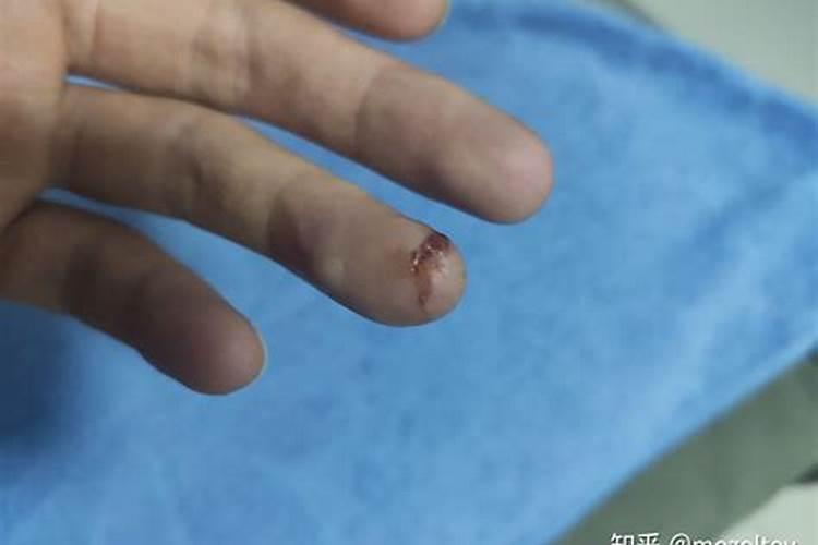 木命戴什么辟邪最旺