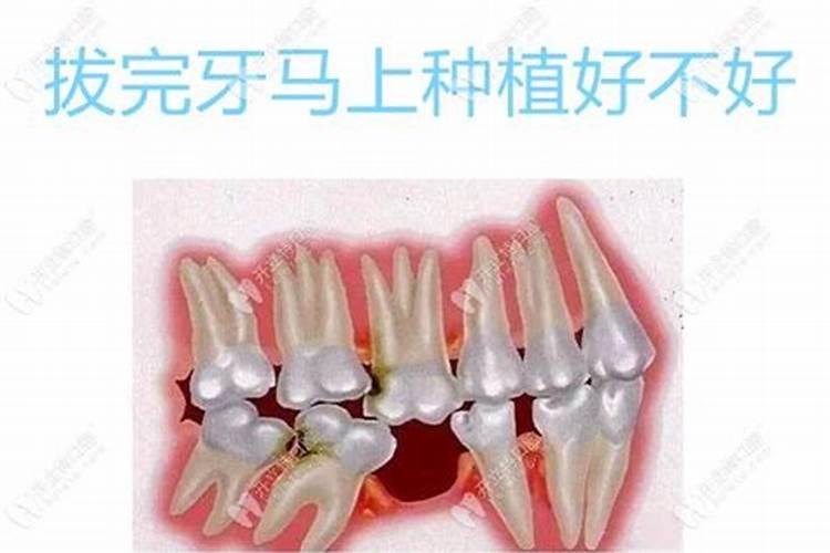 听老人说正月十五没过不能拔牙