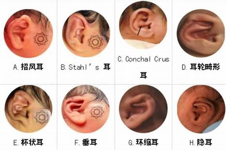 右耳跳动是什么征兆