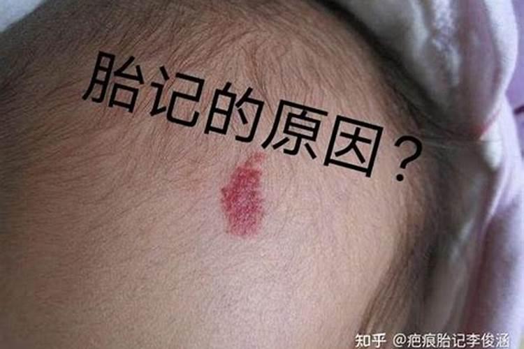 屁股有胎记是有福气吗