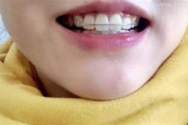 梦到自己满嘴牙都掉了有什么征兆