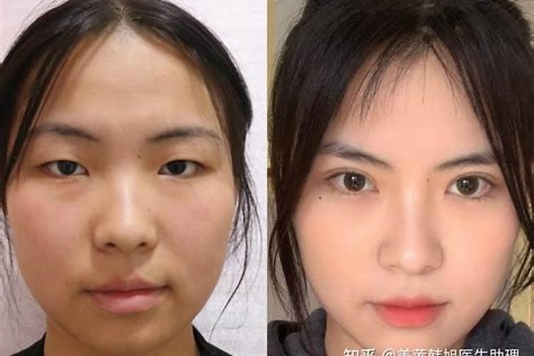 梦见和去世的亲人亲吻的预兆