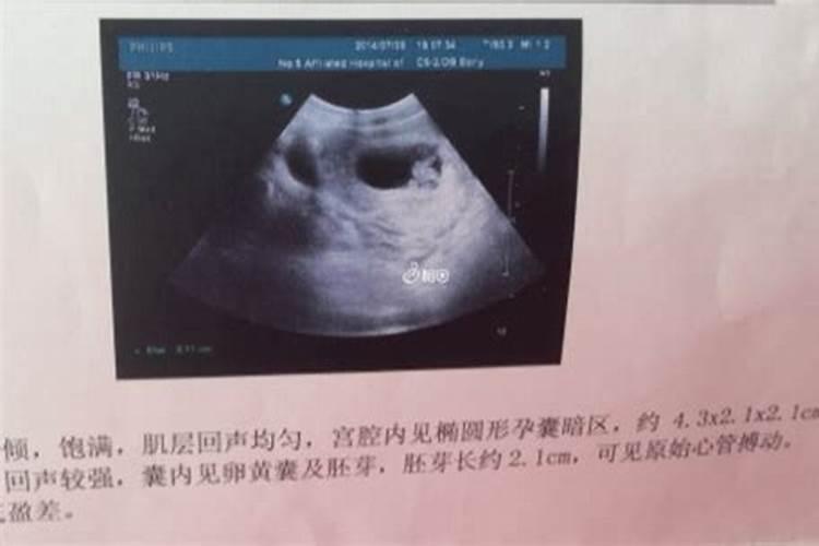孕妇梦到自己考试