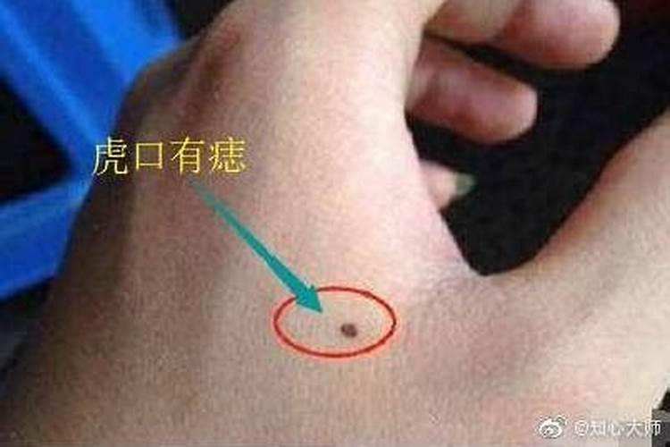虎口有痣的女人有福气吗