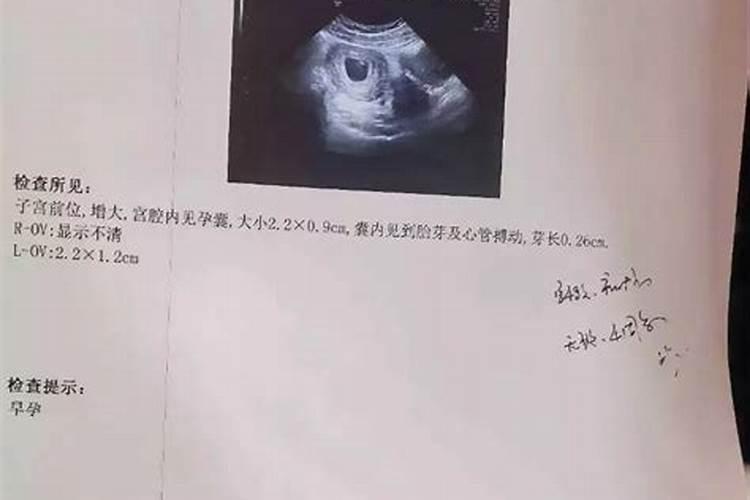 堕胎孩子如何超度？
