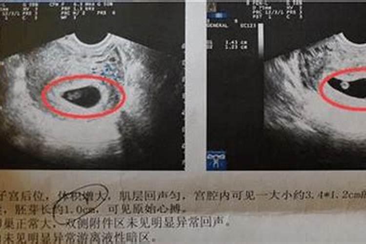 请问算命中的“六厄”是指什么？