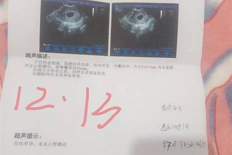 2025年属猪的全年运势