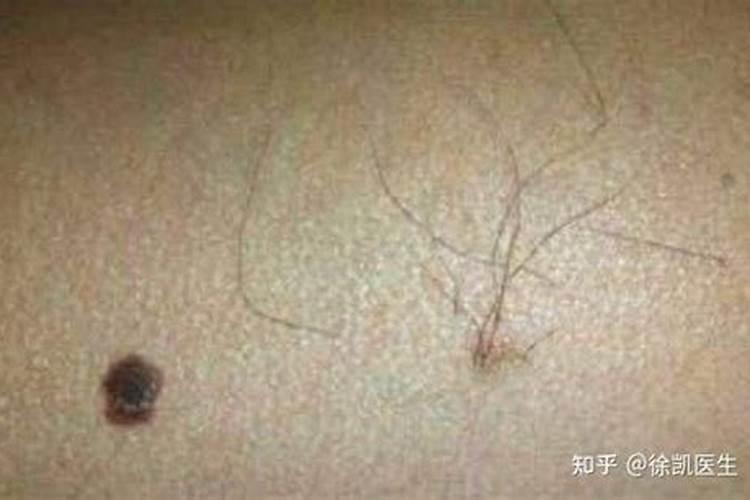 连续做噩梦有什么预兆
