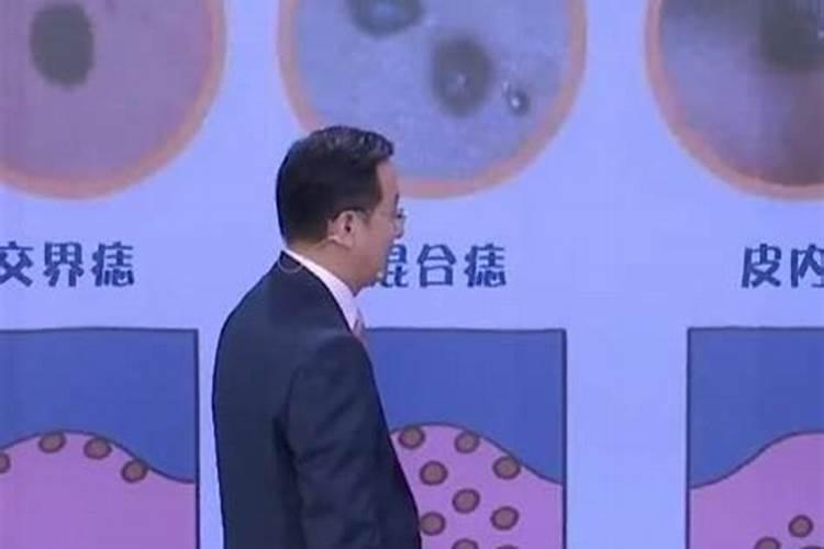 痣上长毛好不好 黑痣上长毛能剪吗