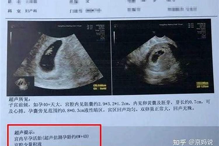 还寿生债怎么查怎么计算
