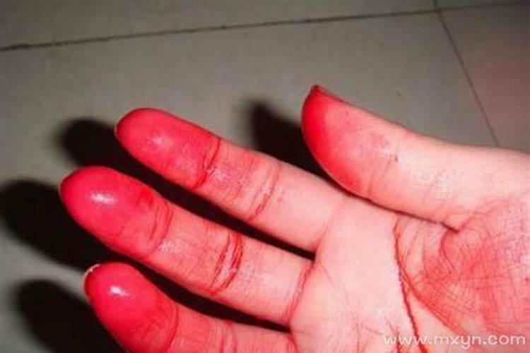 女人梦到手指割破流血 女人梦到手指割破流血是什么预兆