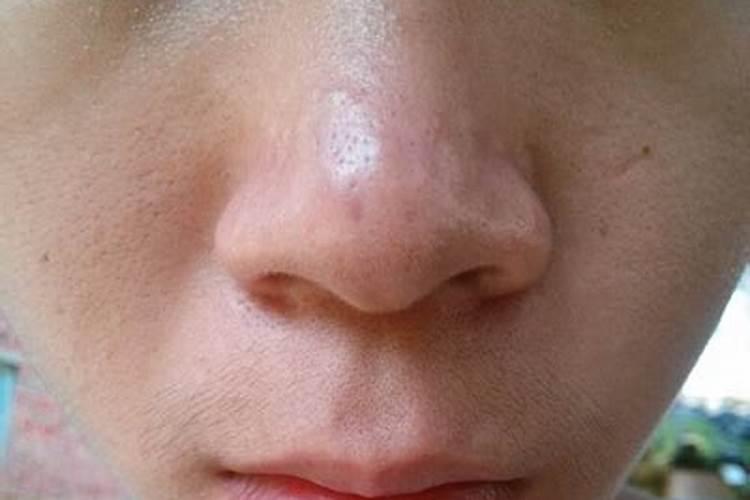 怎么看面相鼻子上有疤痕(婚姻不顺利)