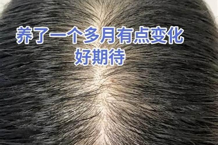 梦见自己秃头是什么意思,预示着什么？