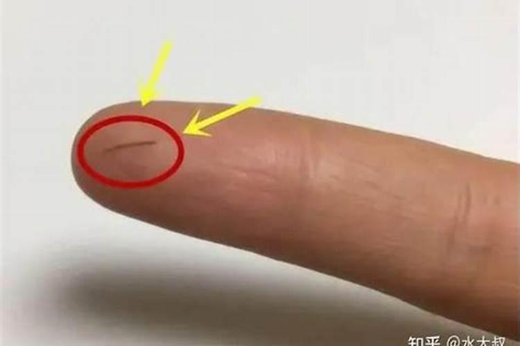 梦到手上扎了刺预示着什么？
